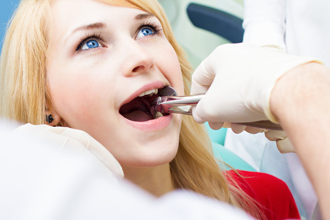 Homeopathy for wisdom tooth extractions